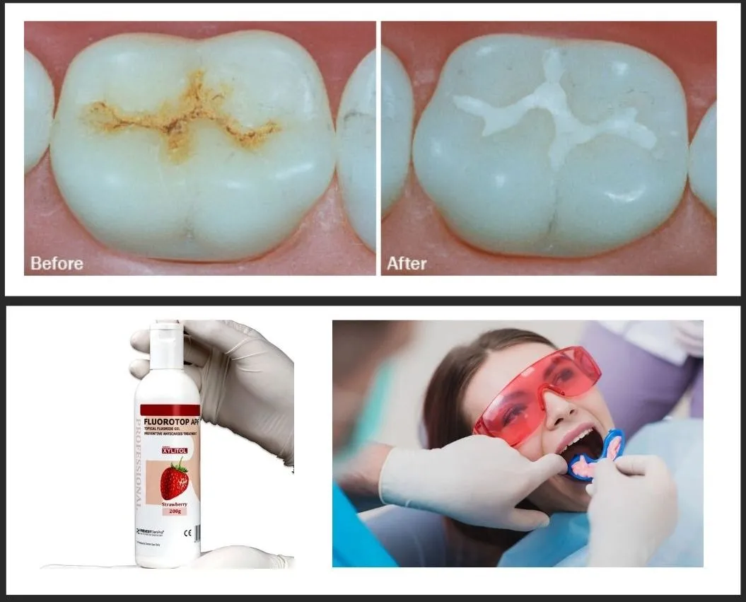 Dental Check-Up